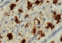 Human MAP2 Antibody MAB8304