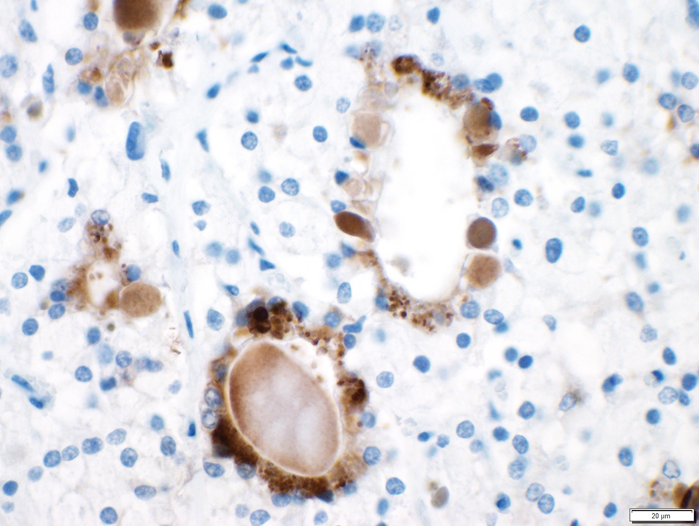 Human Thyroglobulin Antibody MAB8306