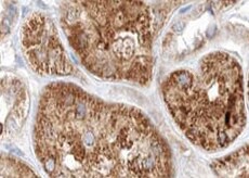 Human Lysosomal  alpha ‑Glucosidase Antibody MAB83291