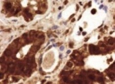 Human Lysosomal  alpha ‑Glucosidase Antibody MAB8329