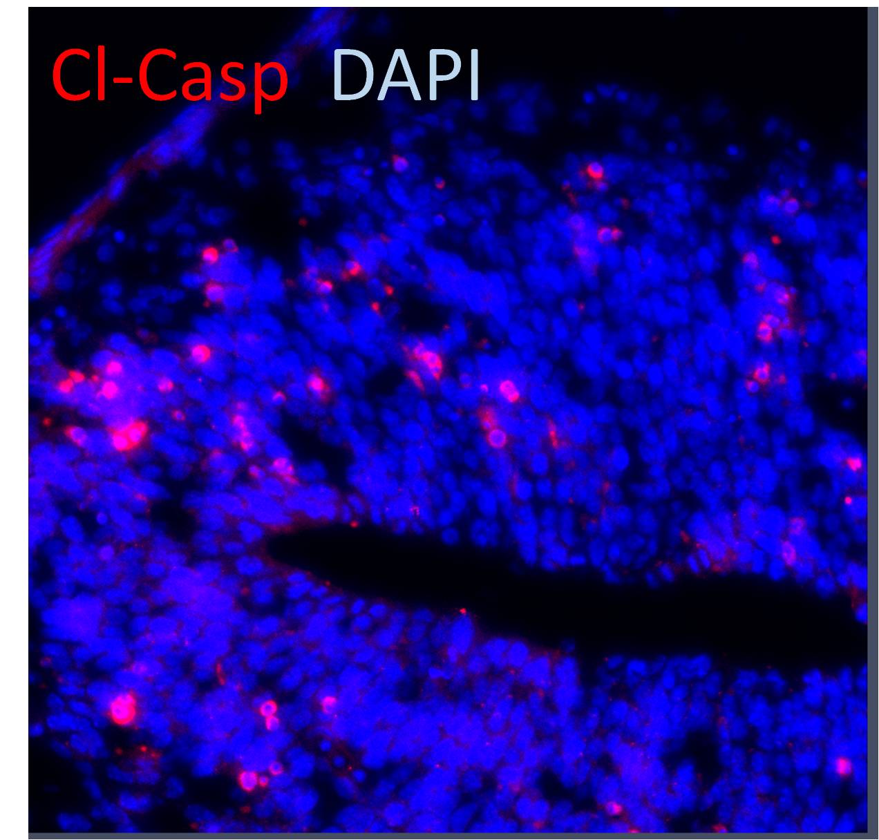Human/Mouse Cleaved Caspase‑3 (Asp175) Antibody MAB835