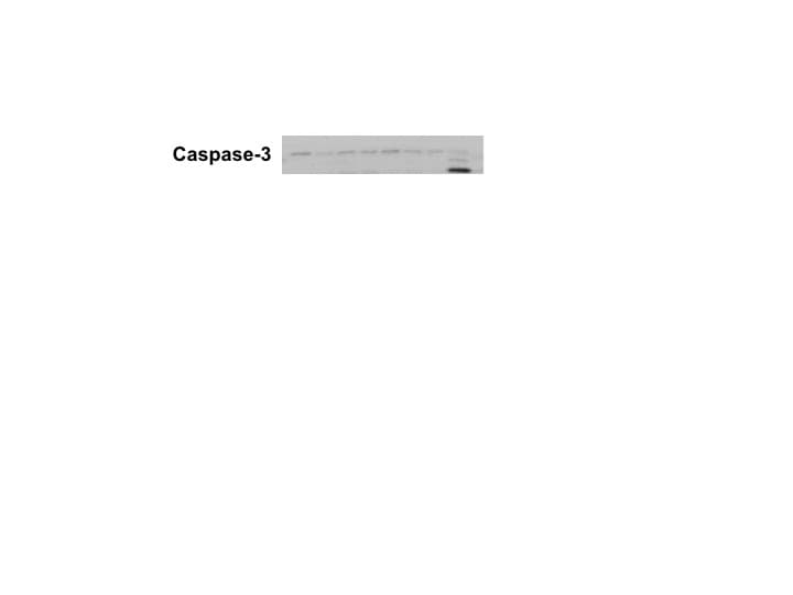 Human/Mouse Cleaved Caspase‑3 (Asp175) Antibody MAB835