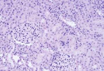 Human/Mouse Cleaved Caspase‑3 (Asp175) Antibody MAB835