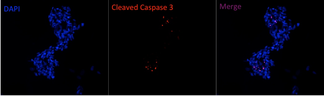 Human/Mouse Cleaved Caspase‑3 (Asp175) Antibody MAB835