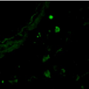 Human/Mouse Cleaved Caspase‑3 (Asp175) Antibody MAB835