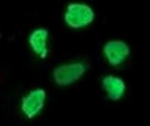 Human/Mouse/Rat HHEX Antibody MAB83771