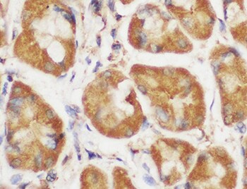Human Pepsinogen A5/PGA5 Antibody MAB8457
