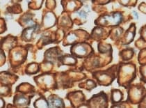 Human Lamin B1 Antibody MAB8525