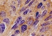 Human LC3A Antibody MAB8558