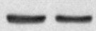 Human/Mouse BID Antibody MAB860