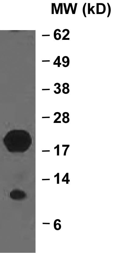 Human/Mouse BID Antibody MAB860