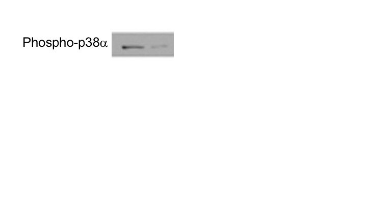 Human Phospho-p38 alpha  (T180/Y182) Antibody MAB8691