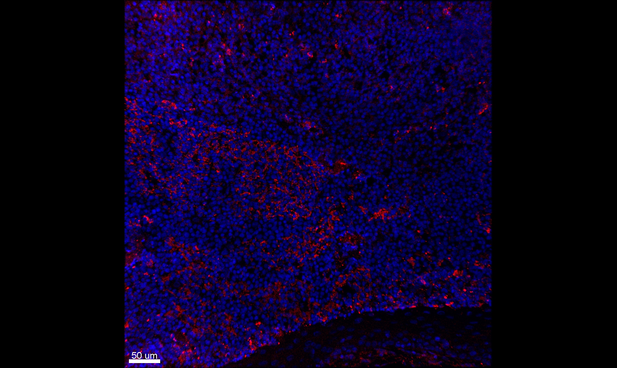 Human IL‑10 R beta  Antibody MAB874