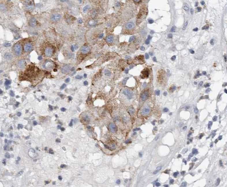 Human IGFBP‑5 Antibody MAB875