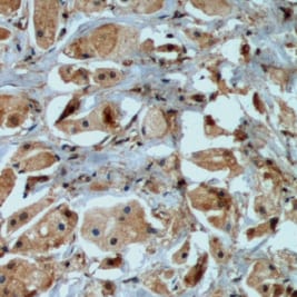 Human IGFBP‑5 Antibody MAB875