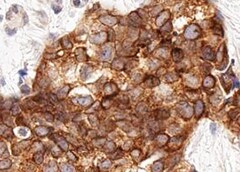 Human Survivin Antibody MAB8861