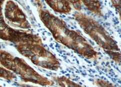 Human GIP Antibody MAB8864