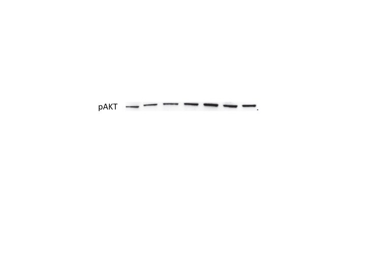 Human/Mouse Phospho-Akt (S473) Pan Specific Antibody MAB887