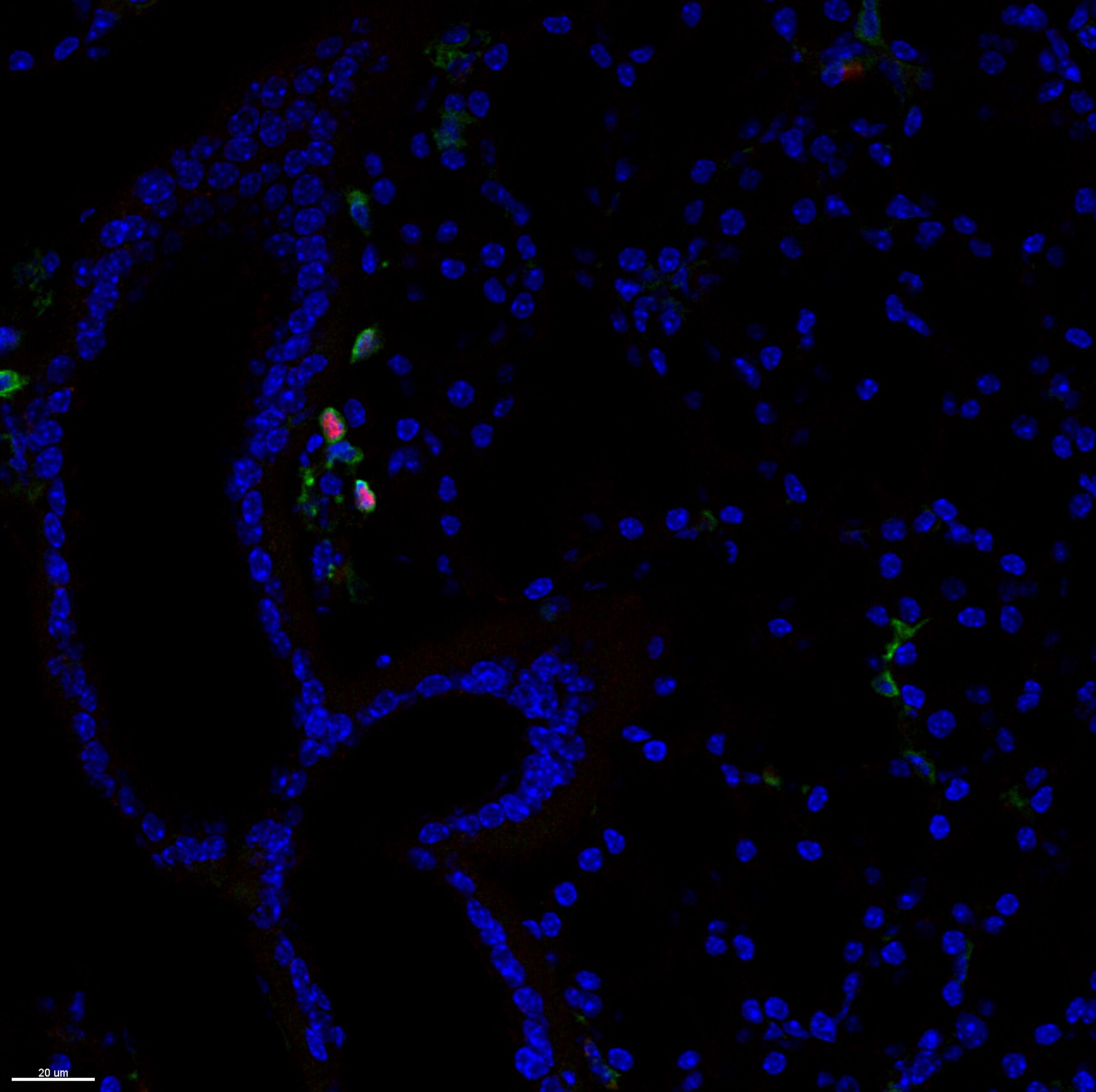 Mouse EOMES Antibody MAB8889