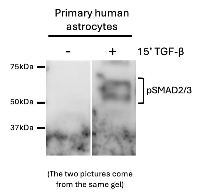 Human Phospho-Smad2/3 (S465/S467) Antibody MAB8935