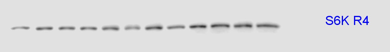 Human/Mouse/Rat p70 S6 Kinase Antibody MAB8962