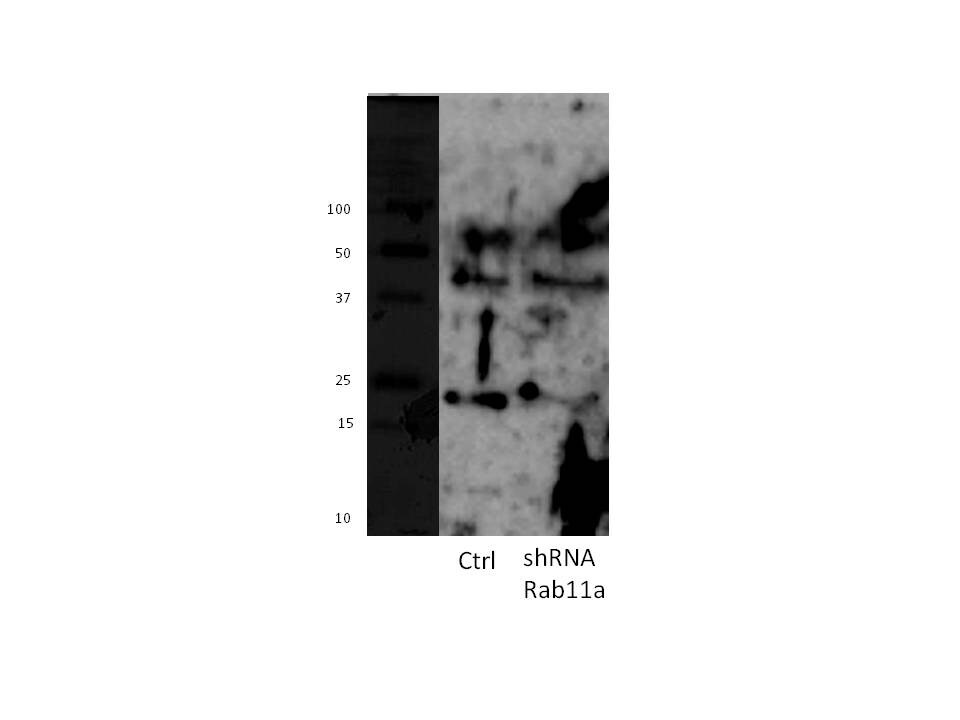 Human/Mouse/Rat Rab11A Antibody MAB8978