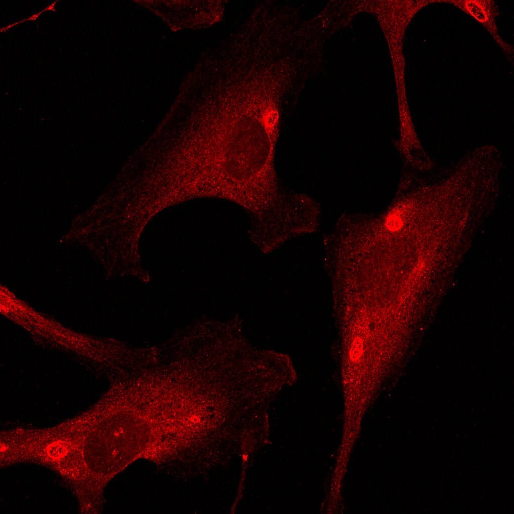 Human/Mouse/Rat Rab11A Antibody MAB8978