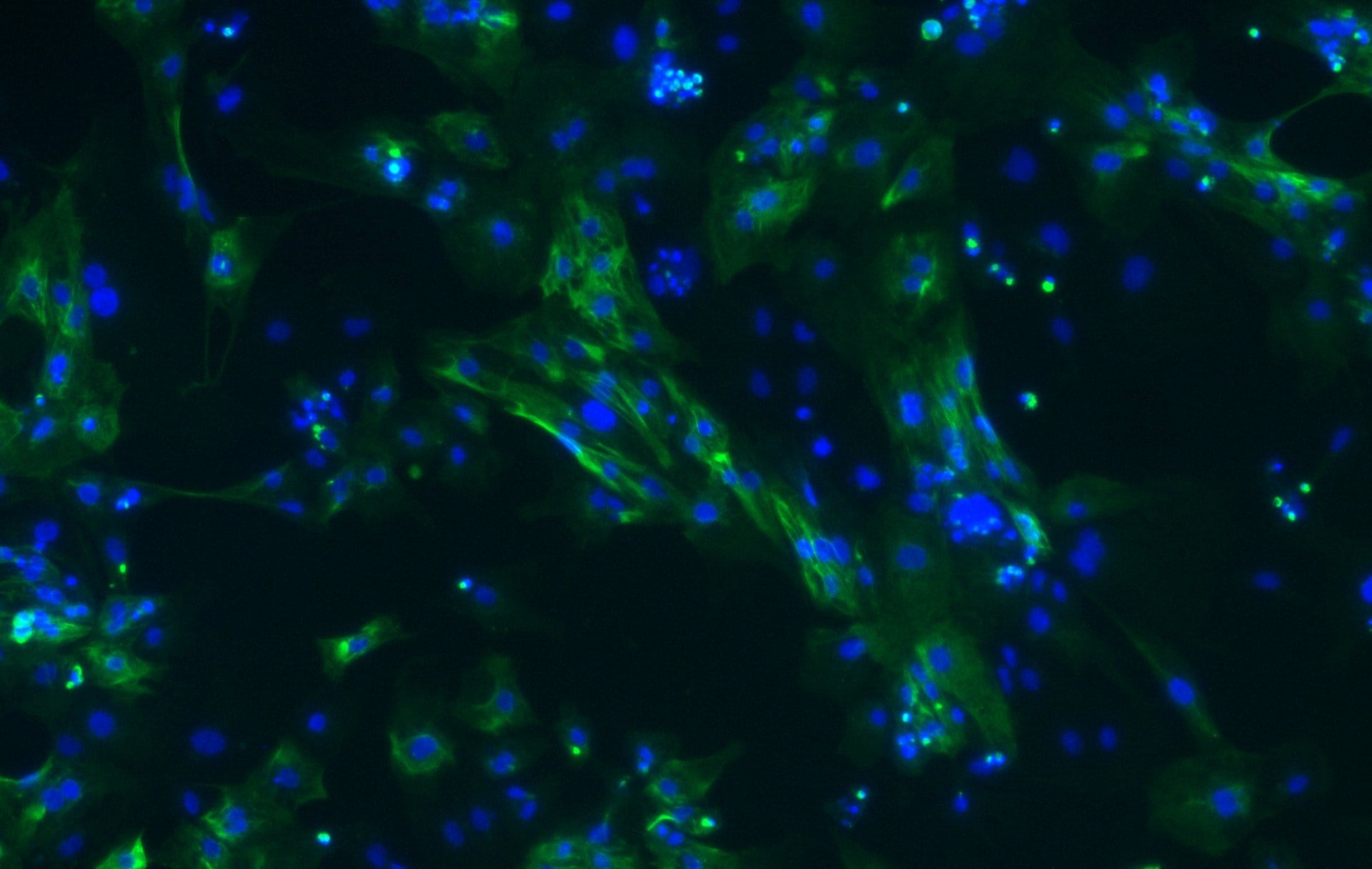 Human MYH6 Antibody MAB8979