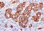 Human MYH6 Antibody MAB8979