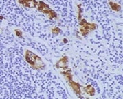 Human MMP‑1 Antibody MAB901