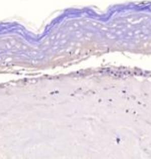 Human MMP‑1 Antibody MAB901