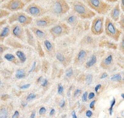 Human MMP‑1 Antibody MAB901