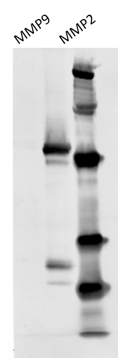 Human MMP‑2 Antibody MAB9022