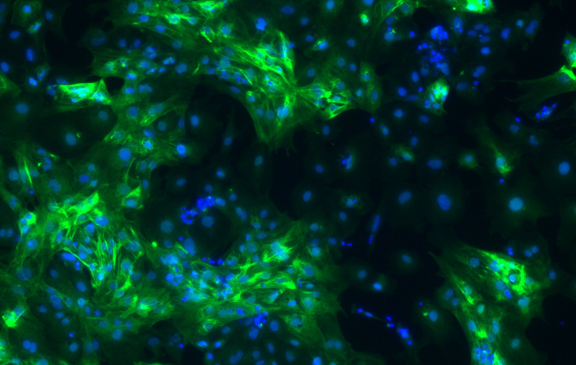 Human MYH7 Antibody MAB90961