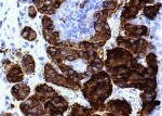 Human Chromogranin A Antibody MAB90981