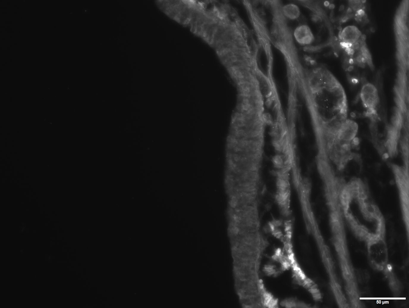 Human MMP‑10 Antibody MAB9101