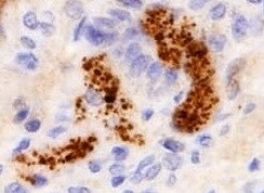 Human TRIM38 Antibody MAB9104