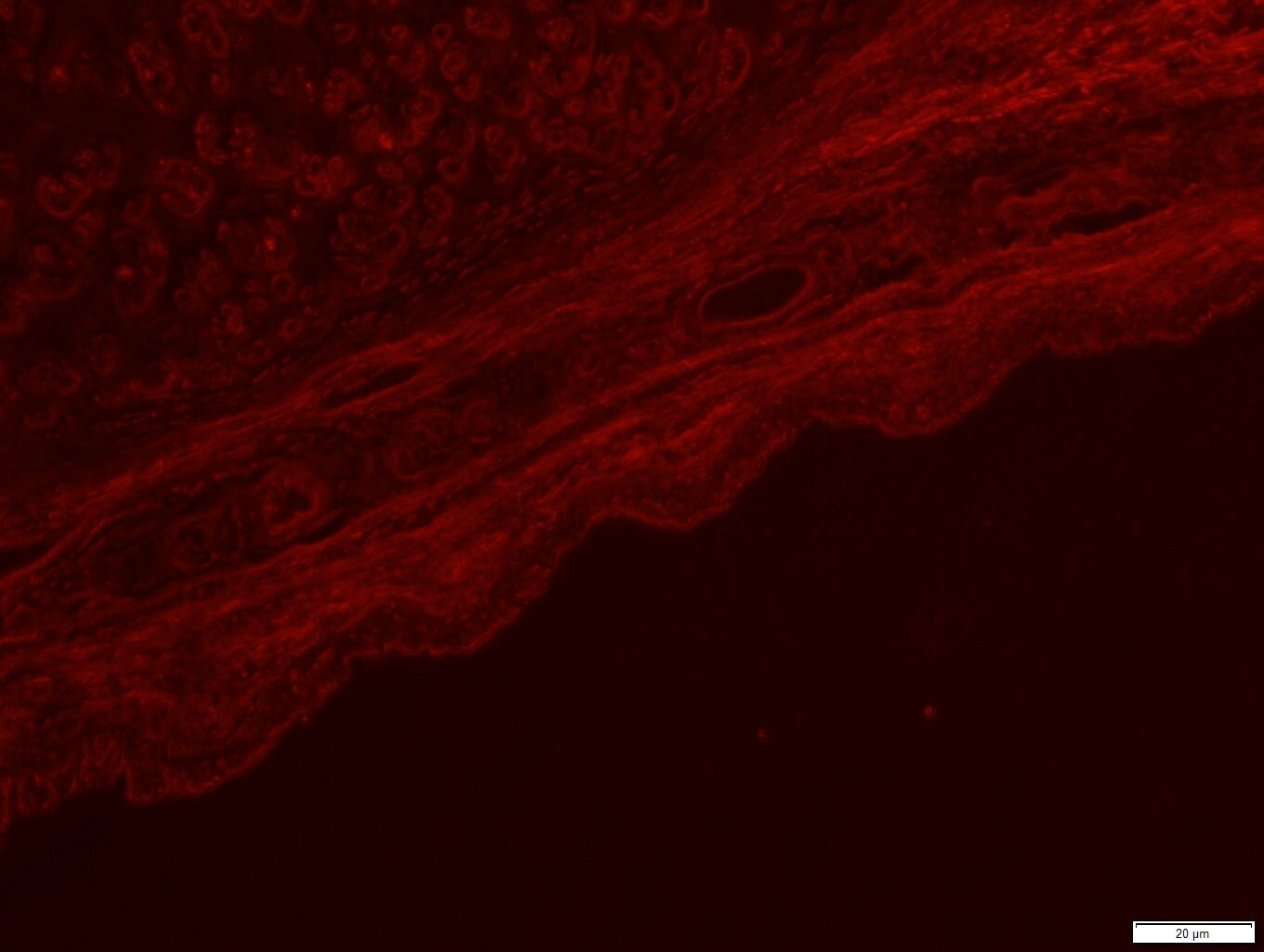 Human MMP‑10 Antibody MAB910