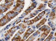 Human MMP‑10 Antibody MAB910