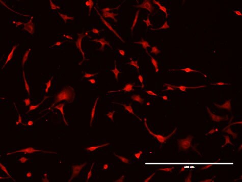 Human Pro MMP‑13 Antibody MAB913