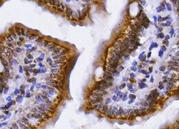 Human IFN-lambda 4 Antibody MAB9165