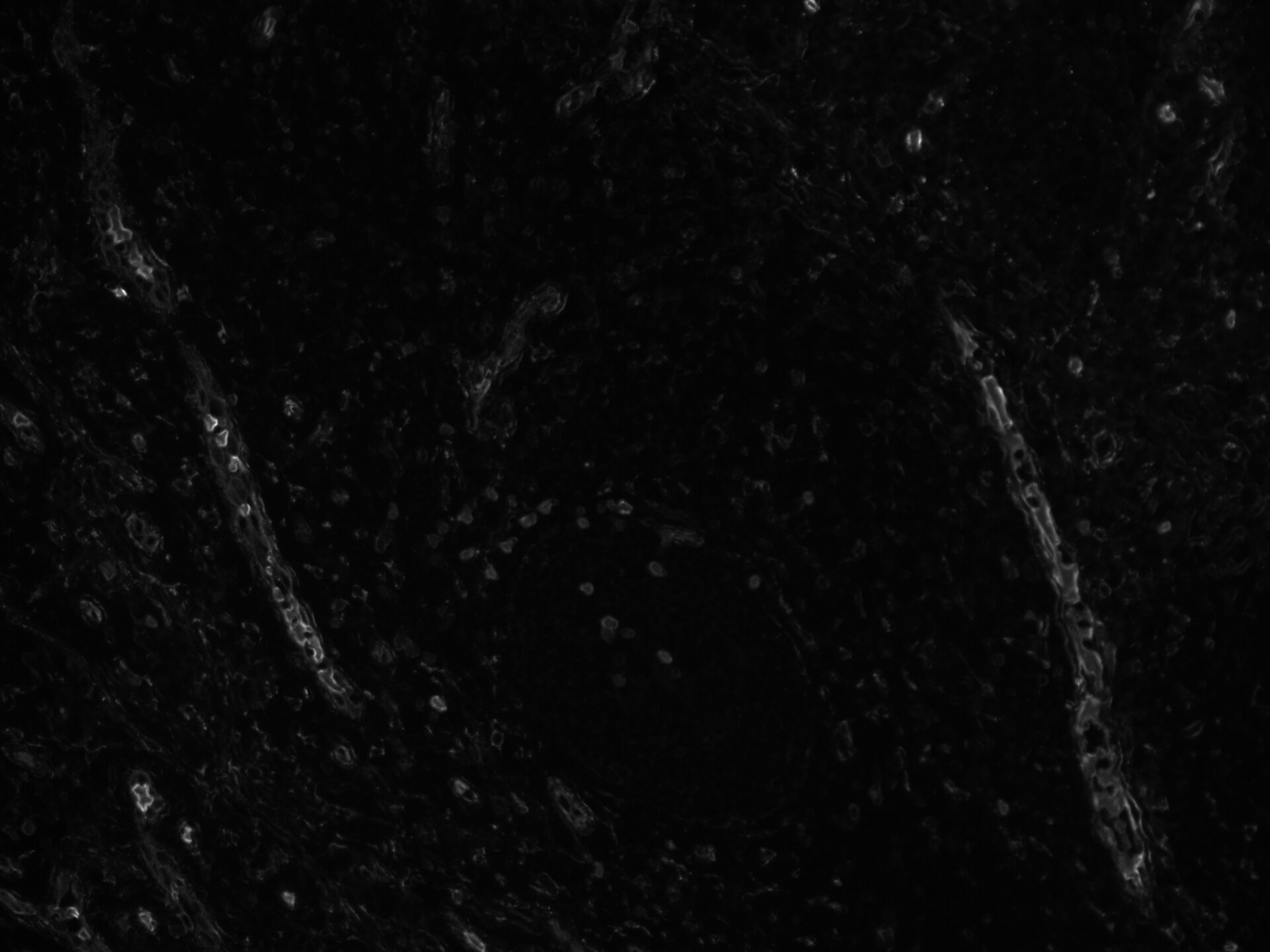 Human HSP47 Antibody MAB91661