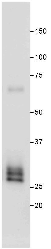 Human Neutrophil Elastase/ELA2 Antibody MAB91671