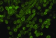 Human Neutrophil Elastase/ELA2 Antibody MAB91671