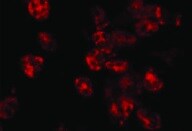 Human Neutrophil Elastase/ELA2 Antibody MAB91671R
