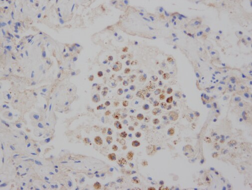 MLKL [p Thr357] Antibody (954724) - Azide and BSA Free MAB91871