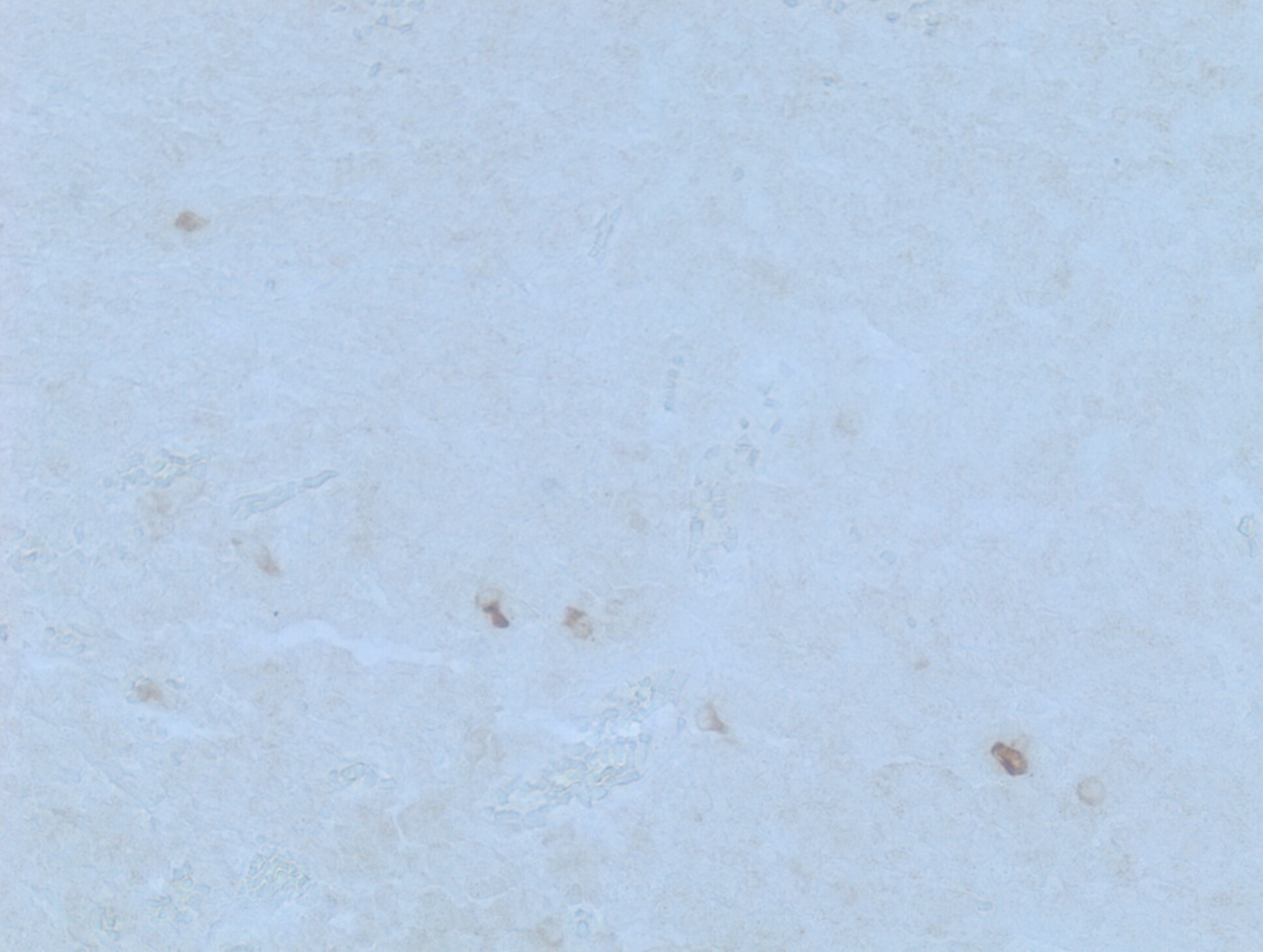 Human MMP‑14/MT1‑MMP Antibody MAB918