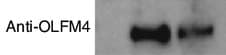 Human Olfactomedin-4/OLFM4 Antibody MAB9218