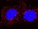 Human ORM2 Antibody (Clone 959445) MAB9306