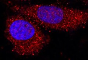 Human HIPK2 Antibody MAB9307